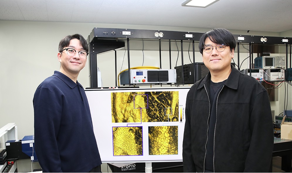 [PNU 리서치] 김지수·이휘돈 교수팀, 지방만 '초정밀 스캔'…차세대 광음향 영상 기술 개발 대표이미지