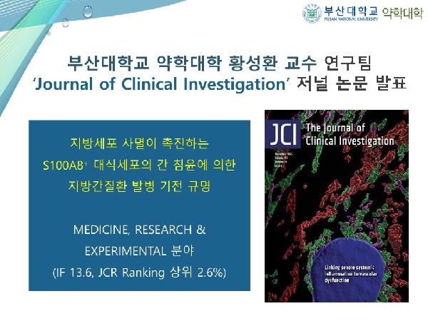 [연구성과] 제약학과 황성환 교수 연구팀 ‘Journal of Clinical Investigation’ 저널 논문 발표  대표이미지